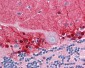 AMPH / Amphiphysin Antibody (Internal)